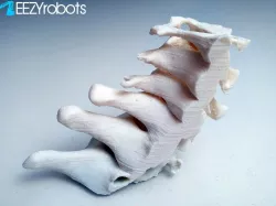 3D printed Cervical Spine