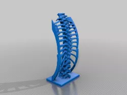 CT Spine