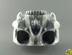 Human Skull