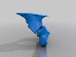 ACETABULUM/fracture