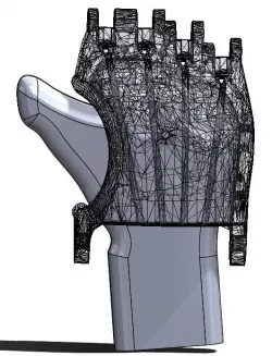 e-NABLE Phoenix Hand v2 - Thumbless
