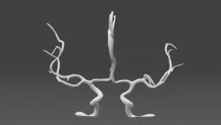 Cerebral arteries - male 3D model