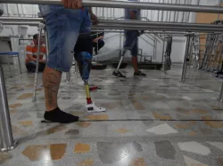 3D Prosthetic foot 