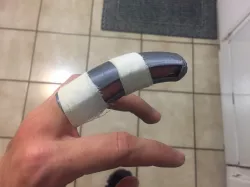 Finger Splint