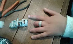 Mechanical Finger Ring prosthesis