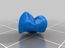 tooth crown