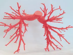 Pulmonary arteries - 2 Piece Snap-Fit