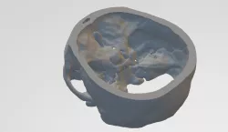 skull base 