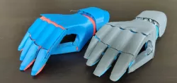 hand prosthesis SDC