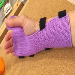 NightSplint