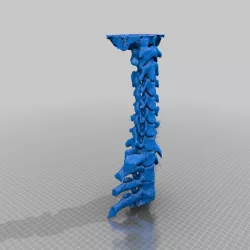 HWS spine