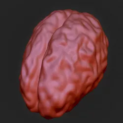 Brain 