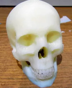 Skull