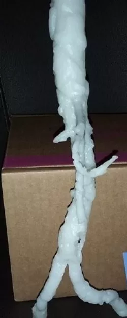 Aorta