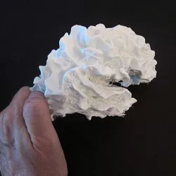 Brain Hemisphere, White Matter of the Right Full-Scale