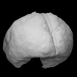 Foetus Brain