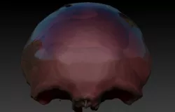 Human Frontal Bone