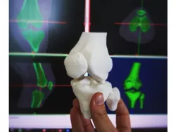 Knee (from CT scan)