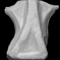 Stone