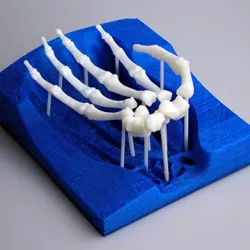 Skeletal Hand