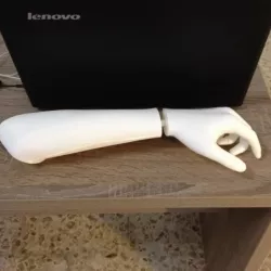 Hand and forearm