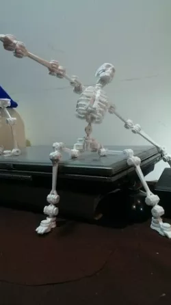 robot about the bone collector