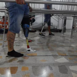 3D print prosthetic foot