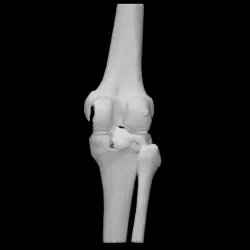 Right knee
