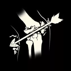 Arrow in the knee
