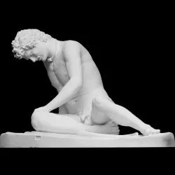 Dying Gaul