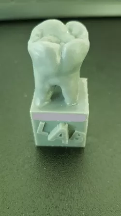 Wisdom tooth