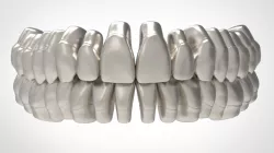Dental Anatomy Library with Thimble Crowns - Azure
