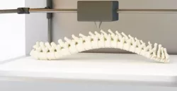 Revolutionizing The Medical Industry With 3D Printing