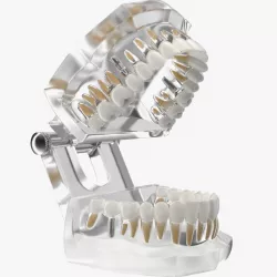 Transparent Dental Typodont With Dental Implants 3d model