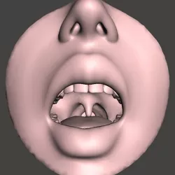 Fleshmouth