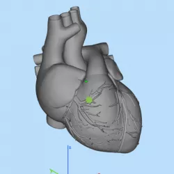heart