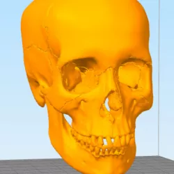 Skull