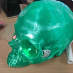 Skull CT Scan w/ Brain Cavity