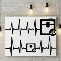 Heart Beat 3D printer  2D