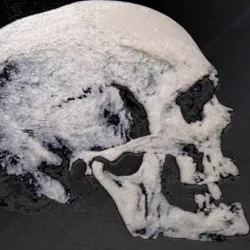 3D skull