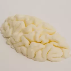 mri brain
