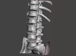 Human spine T10-L5 - male 3D model