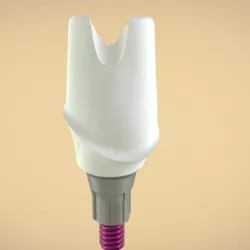 Digital Custom TiBase Abutment
