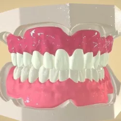 Digital Full Dentures