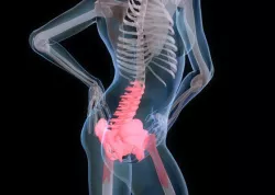 Back Pain medical model
