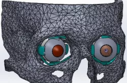 Eye socket