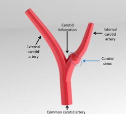 carotid sinuses 3d models 【 STLFinder