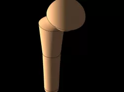 Endoprosthesis