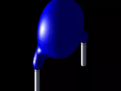 Y2 Safety Capacitor