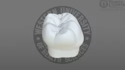 300019 Mandibular 1st Molar